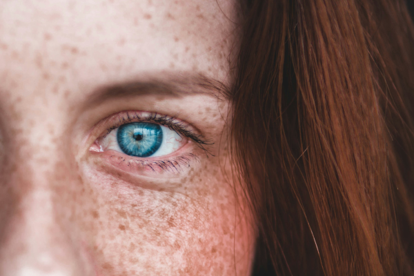 DNA strand overlaid on a close-up of skin texture