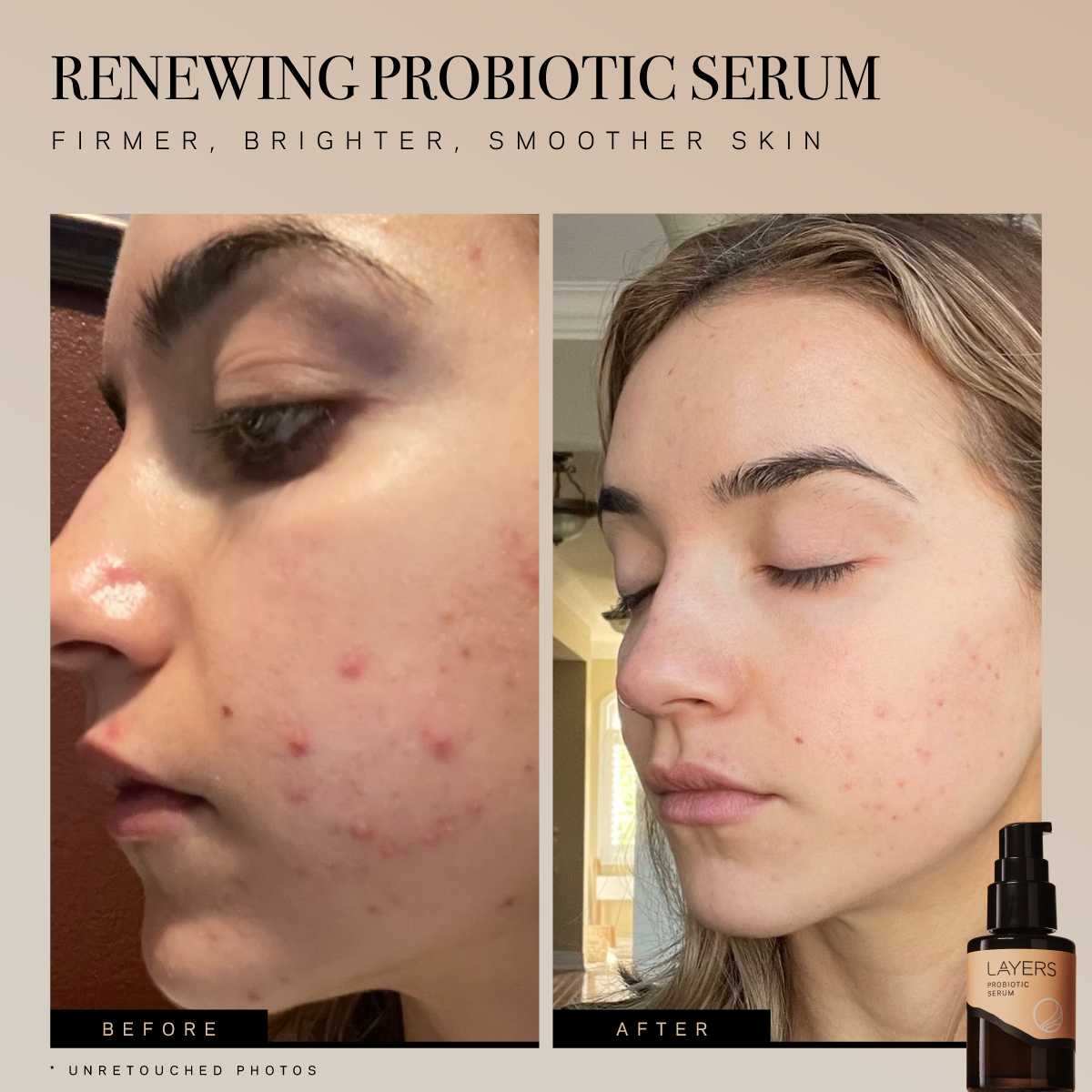 Renewing Probiotic Serum